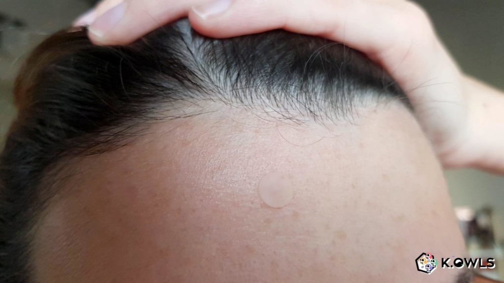 Acne Pimple Master Patch